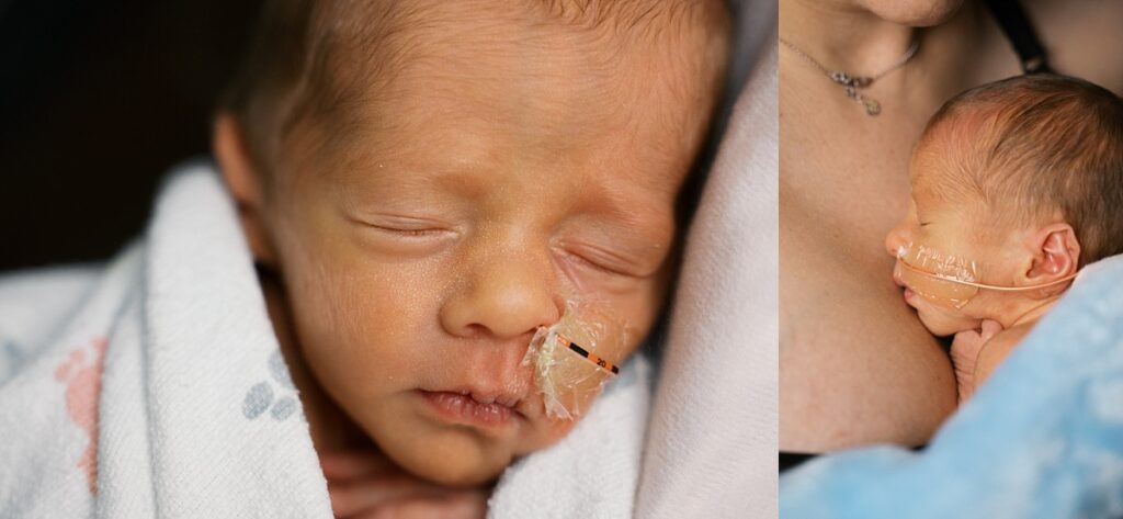 Newborn baby with feeding tube going into nose and small lips image by Portland NICU Photographer Emilie Phillipson Photography