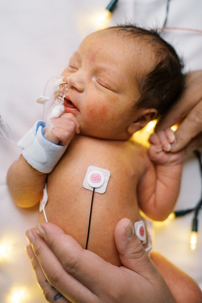 Mom holds hand on baby's bare belly with heart monitors, cords, and breathing apparatus showing, image by Portland NICU photographer Emilie Phillipson Photography. 